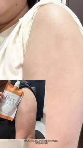 SKINEVER Salicylic Acid Exfoliating Body Lotion Acne Treatment Brightening Sunscreen Lotion