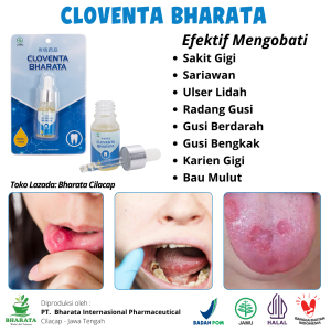 CLOVENTA BHARATA Obat Tetes Sakit Gigi Ampuh Bestandar BPOM