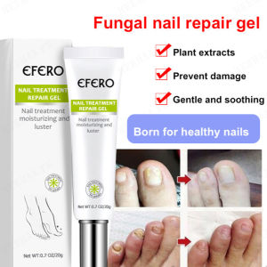 Say Goodbye to Foot Problems with Special Formula