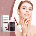 WEST&MONTH Peeling Solution 30ml Exfoliating, Brightening Darkening Brightens The Face And Evens Texture Intensive Serum. 