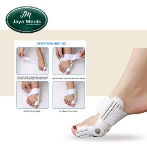 Korektor Jempol Kaki - Bunion - Hallux Valgus 1 Pcs