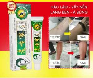 Kem bôi Ngoài Da Chống Nứt Nẻ Á Sừng Bong Tróc Khô Da Cực Hiệu Quả