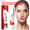 Original Whitening Freckle Cream Pekas Remover FOR ALL SKIN TYPES Melasma Remover Oitment Melasma Cream Pantanggal ng Pekas Pantanggal ng Melasma. 