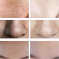 The Ordinary Official Store Skin Care Serum Essence. 