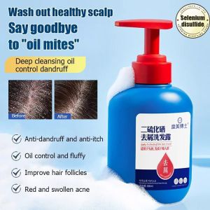 Scalp Care Oil Control AntiDandruff Shampoo Nourishing Hair Root Sulfate Scalp Care Shampoo