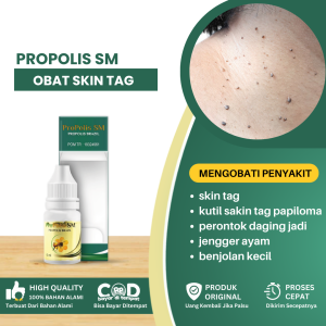 Obat Penghilang Skin Tag Obat Oles Kutil Skin Tag Papiloma Pengelupas Benjolan Kecil Pengecil Daging Jadi - Propolis SM