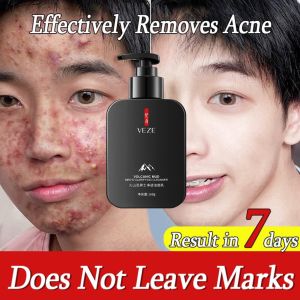 Men Sabun Cuci Muka Sabun Muka Pria Jerawat Dan Berminyak Pembersih Wajah Pria Oil and Comedo Defense Face Wash 168ML
