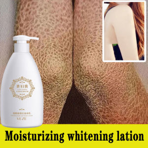 Exfoliate body lotion Ultra hydrating body lotion 500ml moisturizing Brighten Exfoliate the body hands legs Remove dry skin melanin fish scale skin