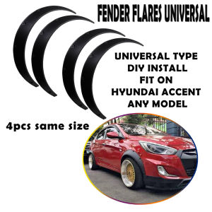 Hyundai Accent Fender Flare Universal Flexible Kit Arch Wheel Eyebrow Protector Black FREE STAINLESS SCREW BOLTS