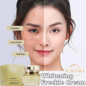 RAVINIA Anti Freckles Whitening Cream 30g Effective Remove Melasma/Dark Spot Brighten Dull Skin