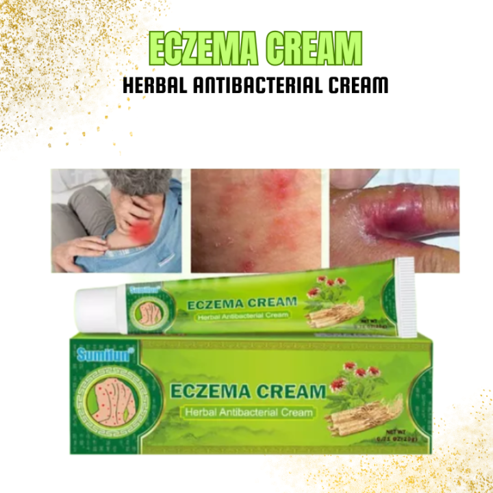 SUMIFUN ECZEMA CREAM HERBAL ANTI BACTERIAL CREAM PSORIASIS DERMATITIS ...