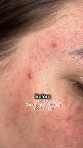 Tinh chất làm mờ vết thâm và làm sáng da AXIS-Y Dark Spot Correcting Glow 5% Niacinamide Serum 50ml