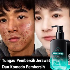 Perawatan wajah pria Pembersih Wajah penghilang jerawat pria Untuk 150g