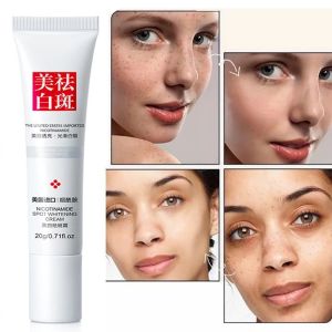 Effective Whitening Freckle Cream Remove Dark Spots Anti Freckle Cream Fade Pigmentation Melasma Brighten Creams Skin Care 20g
