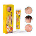 Tiger Balm Antibacterial Cream For Psoriasis Dermatitis Eczema Pruritus Psoriasis Antibacterial And Antifungal Cream. 