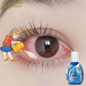 eye drops for clear vision Fresh and Bright Relieve visual fatigue and pseudo myopia nourishing liver Eye dropsOrganic Mineral drops eye
