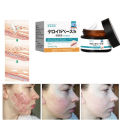 Japan Penghilang Bekas Luka Scar Cream Removal Krim Penghilang scar keloid bopeng bekas luka lama dan baru Old Scar Remover Gel Repairs Whole Body Scars Stretch Marks Pockmarks and Acne Marks 30g. 