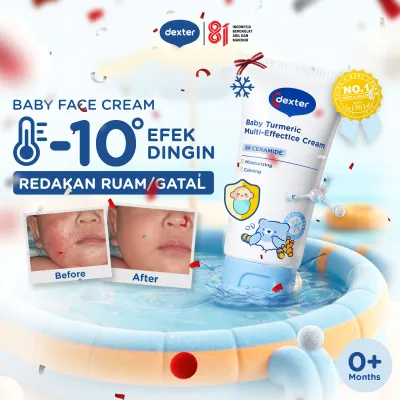 [PRE-ORDER] Dexter Baby Turmeric Multi-Effect Ice Face Cream 50 gr | Membantu Meredakan Ruam Pipi & Gatal-Gatal | dengan 5X Ceramide dan Panthenol | Memperkuat Skin Barrier Kulit Wajah Bayi yang Sensitif