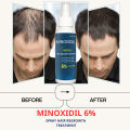 MINOXIDIL Hair Grower BEARD AND HAIR GROWTH SPRAY Nexxus Minoxidil spray regowth treatment Minoxidil. 