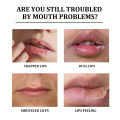 Eelhoe Moisturizing Lip Balm Aloe Dilute Fine Lines Long Lasting Moisturizing Repairing Dead Skin Anti Dryness Cracking Moisture Lip Balm Prevent Broken Skin Dry Cracked Lips Aloe Lip Balm Fade Lip Lines Remove Dead Skin Lip Gloss Moisturizer 4.7g. 