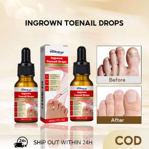 Dưỡng Móng Tay Chân Hết Sạch Nấm Móng Bọng Móng Hư Khoé Nước Ăn Tay Chân Dưỡng Cứng Móng