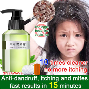Lice Remover Shampoo Licealiz Head Lice Treatment Shampoo Treatment Lice Remover Shampoo 100ml