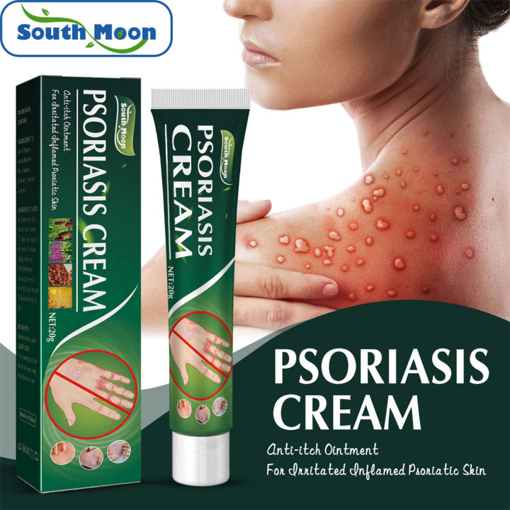 SouthMoon Psoriasis Cream Repair Skin Moss Hand And Foot Moss Relieve ...