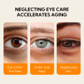 LANBENA Eye Patch Remover Eye Bag Dark Circles Removal Antioxidant Vitamin C Eye Mask Under Eyes Patches Anti-aging Skincare Beauty Eye Patches 60Pcs（BUY 1 TAKE1）. 