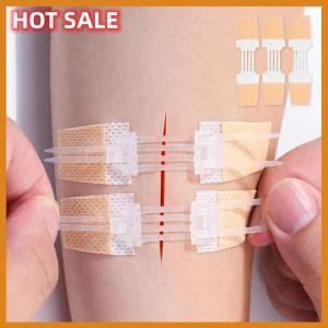 🔥🔥🔥dingdaocunz Zipper Band-aid Painless Wound Closure Patch Suture-free Wound Dressing Patches Zip Suture Reducer Band Aid Outdoor Portable