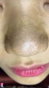 Sufficient stock Dr. Leo White Clay Mask Blackhead Removal Deep Pores Cleansing Clay Mask 100g