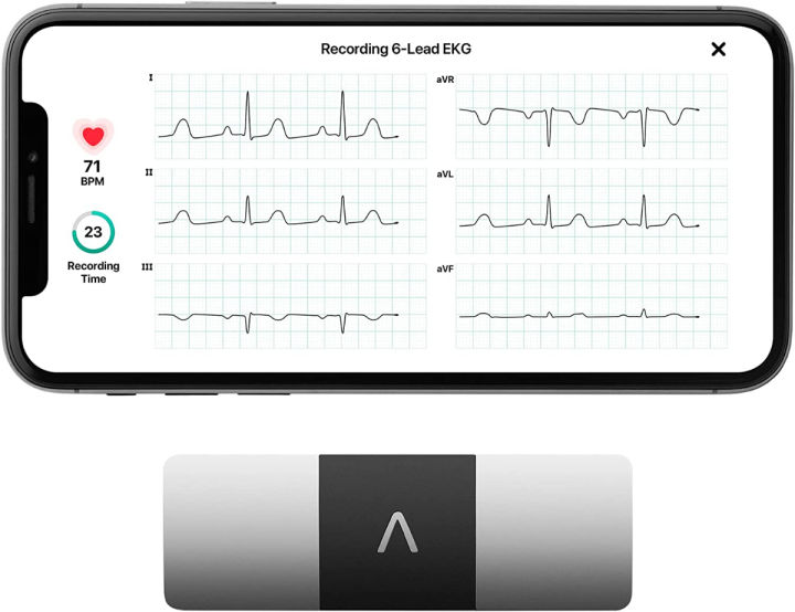 ‎AliveCor KardiaMobile 6-Lead Personal EKG Monitor – Six Views Of The ...