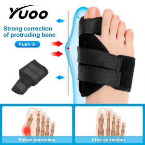 YUOO อุปกรณ์แก้ไขที่ยืดหัวแม่มือใหญ่เฝือกปลายเท้าบรรเทาอาการปวดเท้าปรับปรุงนิ้วหัวแม่เท้าผิดรูปและศัลยกรรมกระดูก1คู่