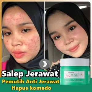 Salep Jerawat Acne Night Cream 50gr BPOM Krim Penghilang Bekas Jerawat Obat Jerawat paling ampuh Acne Day Cream Whitening Salep Bopeng Flek Noda Hitam Anti Acne Mengecilkan Poripori Mencerahkan kulit Memperbaiki Skin Barrier Acne Spot Treatment Expert