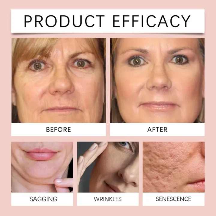 20pcs/Box%20Collagen%20Peptide%20Facial%20Mask%2014%20Days%20Firming%20Skin%20Reducing%20Wrinkles%20Deep%20Hydration%20Anti%20Aging%20Brightening%20Elasticity%20Boost%20-%20Image%203