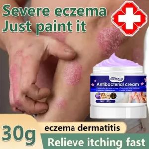 Antibacterial Cream Kem bọ cạp bôi nấm ngứa hắc lào á sừngvẩy nến Da Đầu  Gói Chống tái đi kèm hàng sẵn giao nhanh