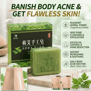 Skin Purifying Mugwort Detox Soap Plant-Based Facial Cleansing Soap Back Itching Relief Handmade Bar Soap for Men and Women