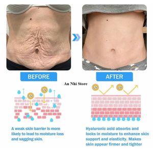 [ Combo 3 ] Kem Dưỡng Da Toàn Thân Giúp Căng Mịn Săn Chắc Ngăn Lão Hóa Dưỡng Ẩm Da Mềm Mại Phục Hồi Đàn Hồi Cho Làn Da Tươi Trẻ