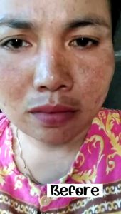 Paket Brightening Premium Radiance Bright Package BG Skin