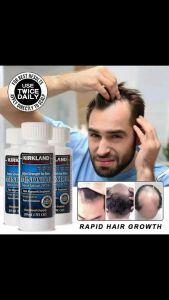 Thuốc mọc tóc mọc râu Minoxidil 5% Kirkland nguyên hộp 6 chai