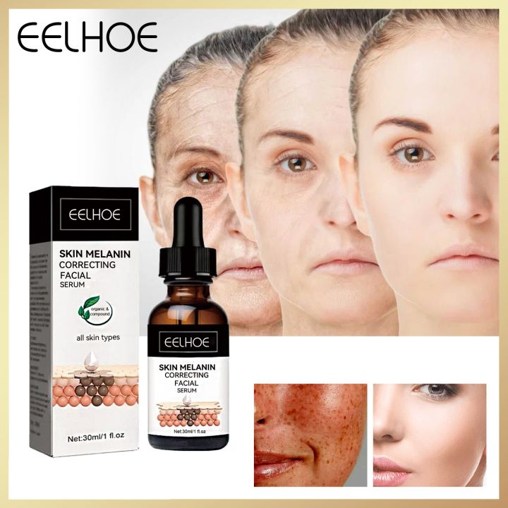 Eelhoe Facial Melanin Correcting Serum Remove Melasma Whitening Skin ...