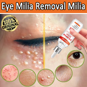 Fat granule remover 30ml 脂肪粒去除 Eye cream Eye removing magic device to remove fat particles Syringoma eye surrounding small granulation miliaria papule essence