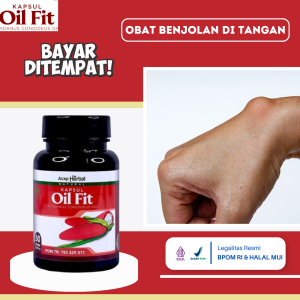 Obat Benjolan Di Tangan Obat Penghancur Benjolan Di Tangan Obat Benjolan Di Tangan Dan Pergelangan Tangan Obat Benjolan Lemak Di Tangan Benjolan Sakit Dan Berair Obat Kista Ganglion Dengan Oil Fit
