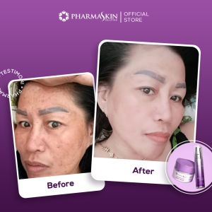 Perawatan Dasar Spesialis Flek Menahun by Pharmaskin Solution