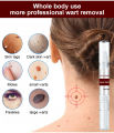 H Wart Removal Liquid Pen/Mole removal care pen 3ml. 