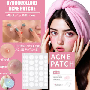EFFECTIVE Waterproof Acne Pimple Patches 72PCS Jerawat Plester Jerawat Mensterilkan Melawan Peradangan  Acne Patch  Hydrocolloid Stickers Pimples Removal Facial Skin Care