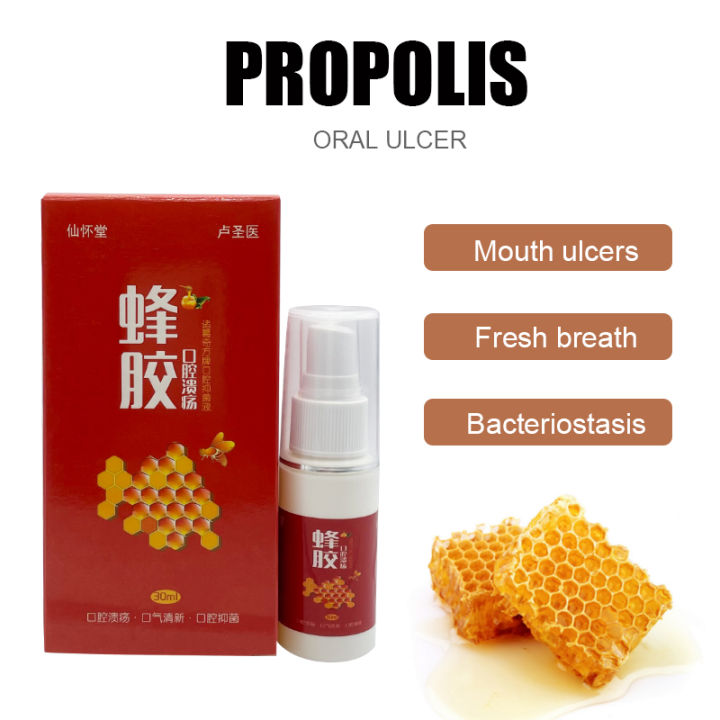 20ml Propolis Oral Ulcer Spray Oral Anti-inflammatory Bacteriostatic ...