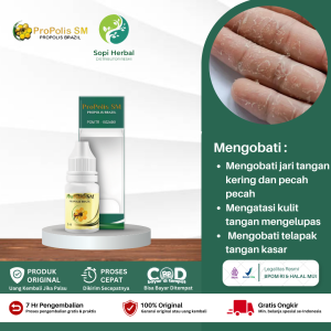 Obat Jari Tangan Kering Obat Jari Tangan Pecah Pecah Obat Kulit Tangan Mengelupas Obat Gatal Di Jari Tangan Obat Telapak Tangan Kasar Obat Tangan Pecah Kering Dengan ProPolis SM