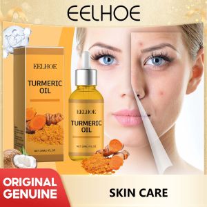 EELHOE Turmeric Oil 30ml Pure Turmeric Essential Oil Freckle Whitening Serum Anti-Wrinkle Lifting Firming Fade Spots Skin Care Brighten Fade Acne Dark Spot Pigmentation Melanin Corrector Moisturizing Skin Care