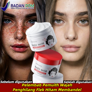 Kojic Acid Whitening Freckle Cream 30g Krim Penghilang Flek Hitam Melasma Cream Kojic Acid Whitening Freckle Cream Dark Spot Moisturizer Glowing Moisturizing Krim Siang dan Malam Anti Kerut Anti Penuaan Mengecilkan pori-pori