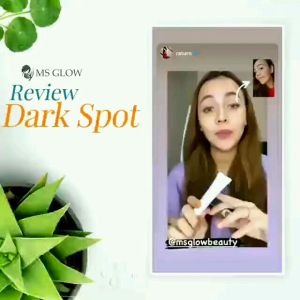 MS GLOW Dark Spot Treatment Serum Pencerah Wajah Penghilang Flek Hitam Membandel